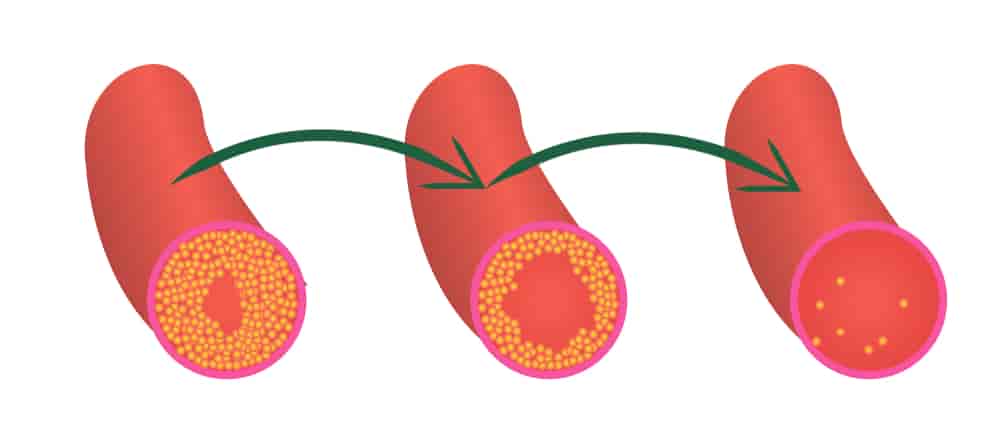 lower cholesterol foods